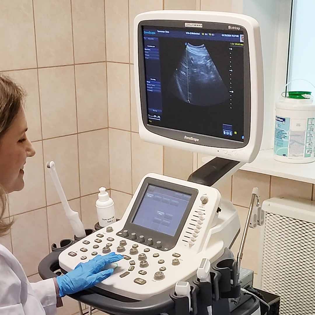 УЗИ брюшной полости в Клинике женского здоровья в Перми